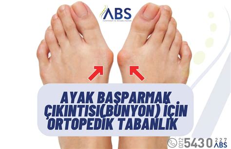 ayak başparmağının artrozu tedavisi